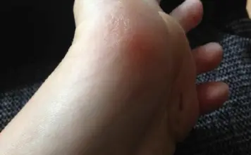 Kleine geile Käsefüße Leck meine Käsefüße